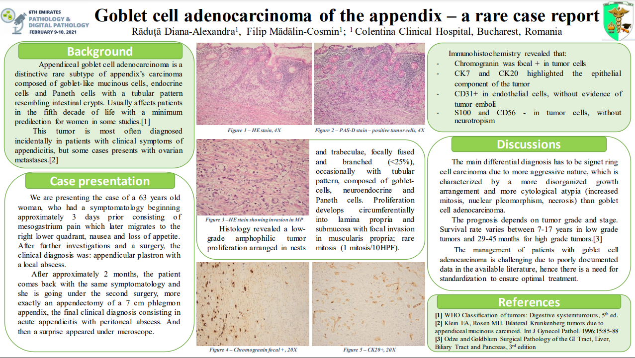 Diagnostics | Free Full-Text | Appendiceal Signet Ring Cell Carcinoma: An  Atypical Cause of Acute Appendicitis—A Case Study and Review of  Current Knowledge